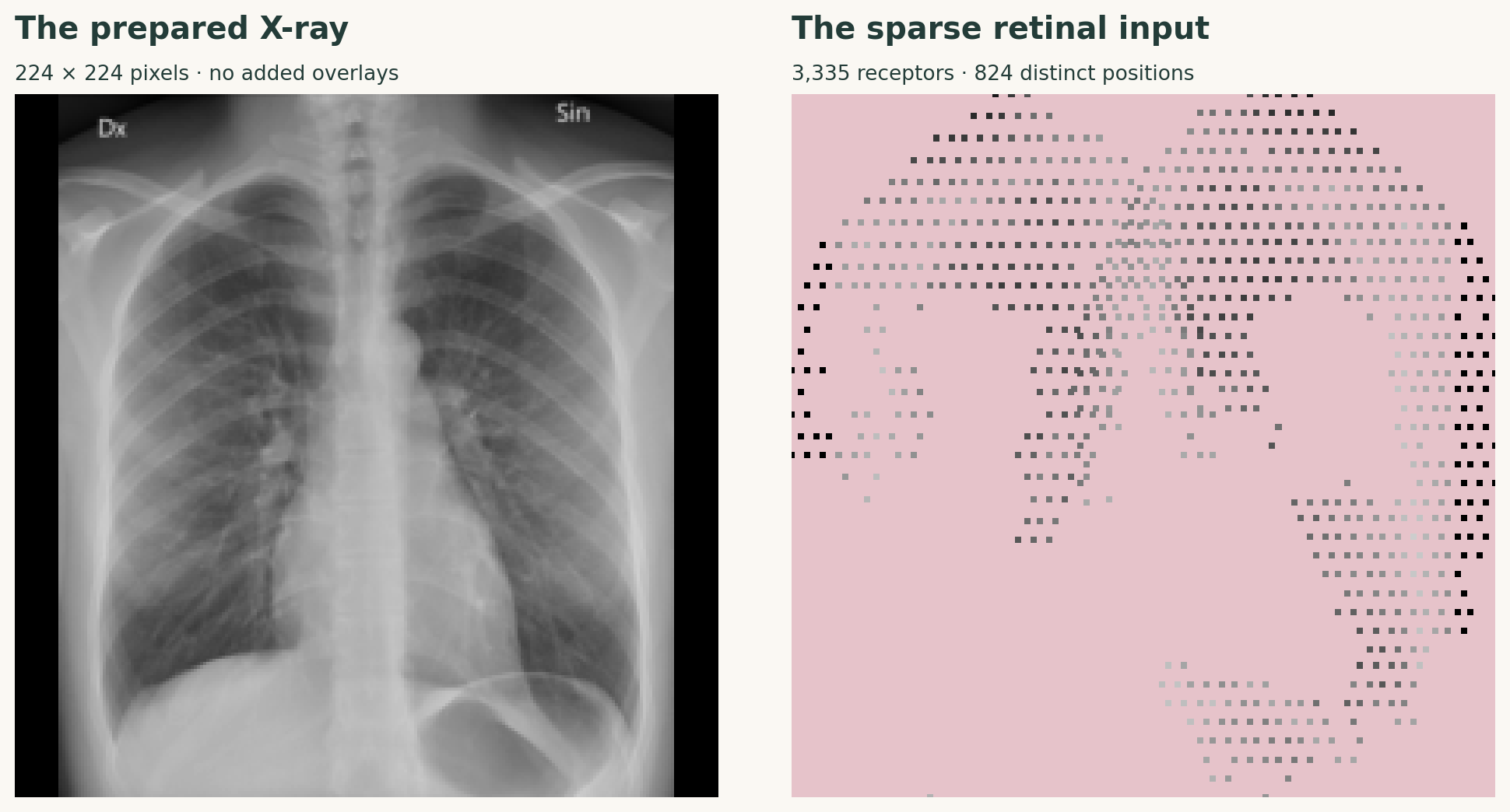 Prepared frontal chest radiograph.